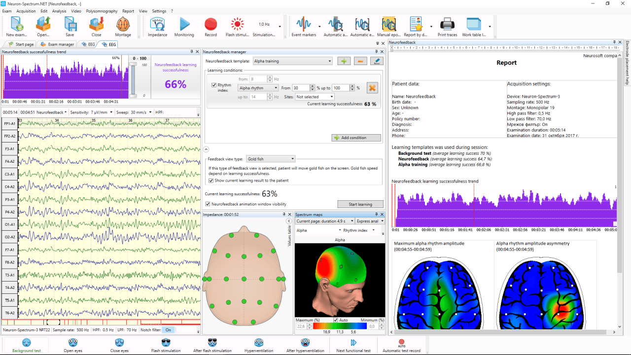 Neuron-Spectrum-1/BFB