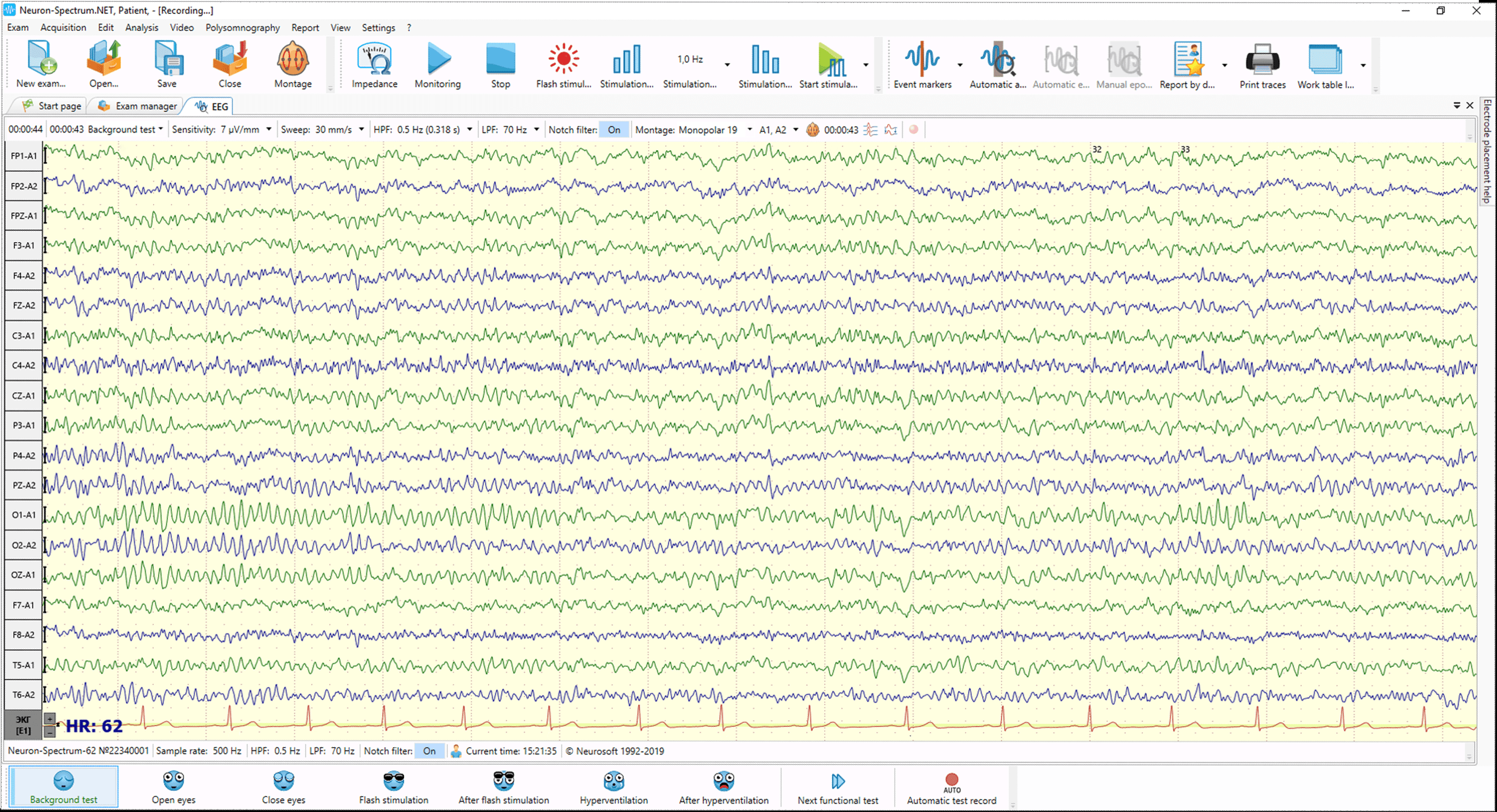 Neuron-Spectrum-63