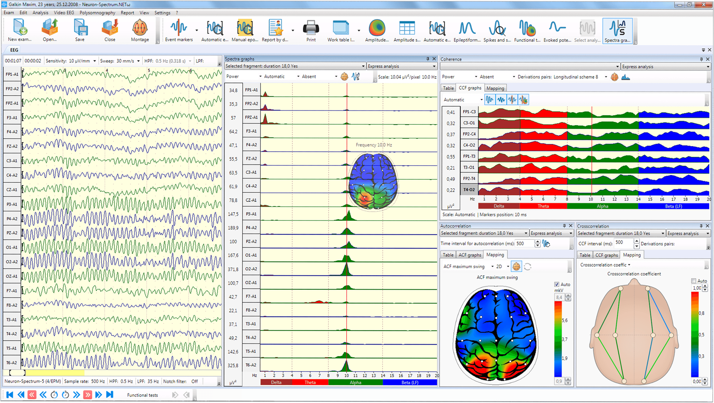Neuron-Spectrum-63