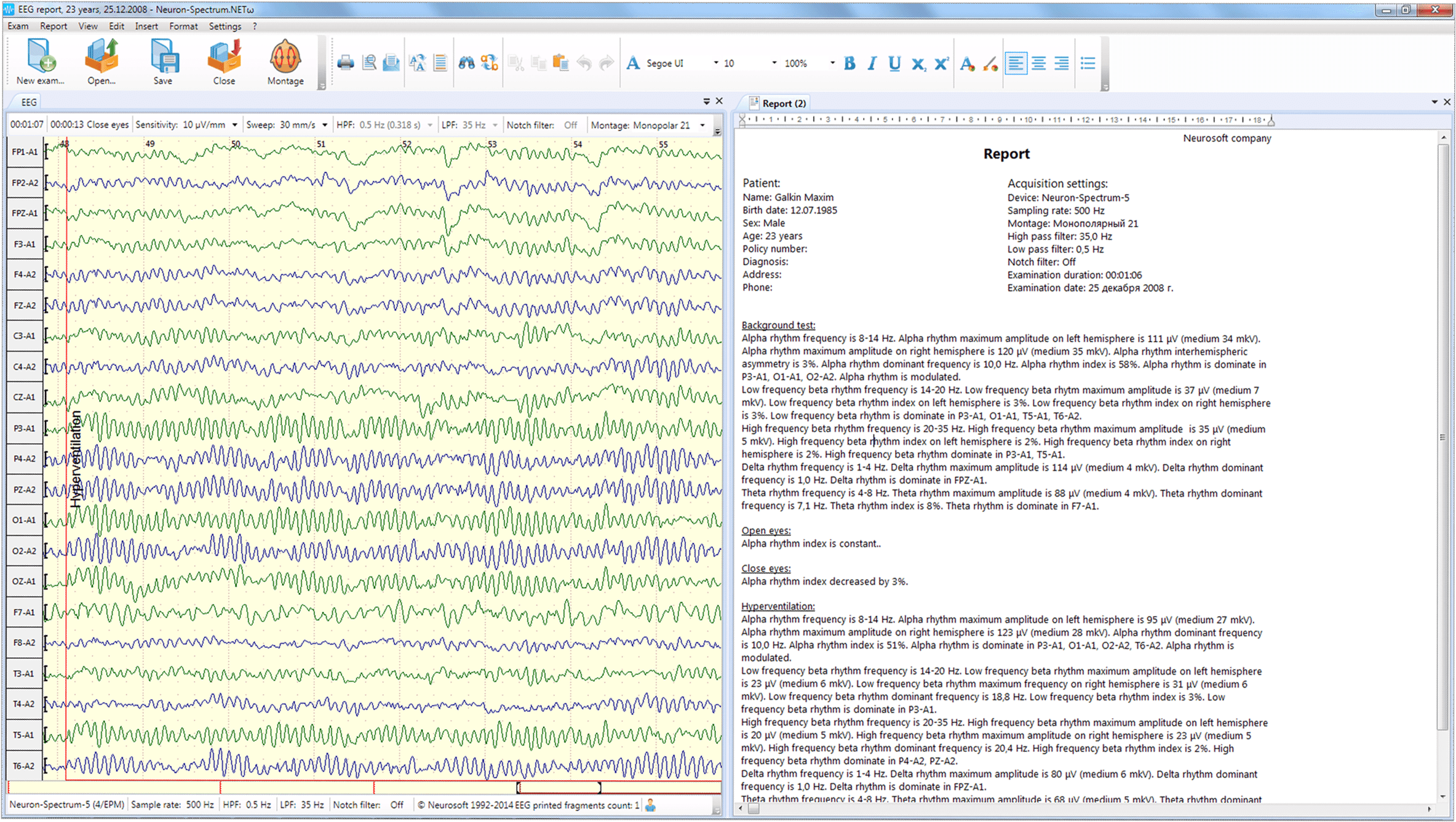 Neuron-Spectrum-63