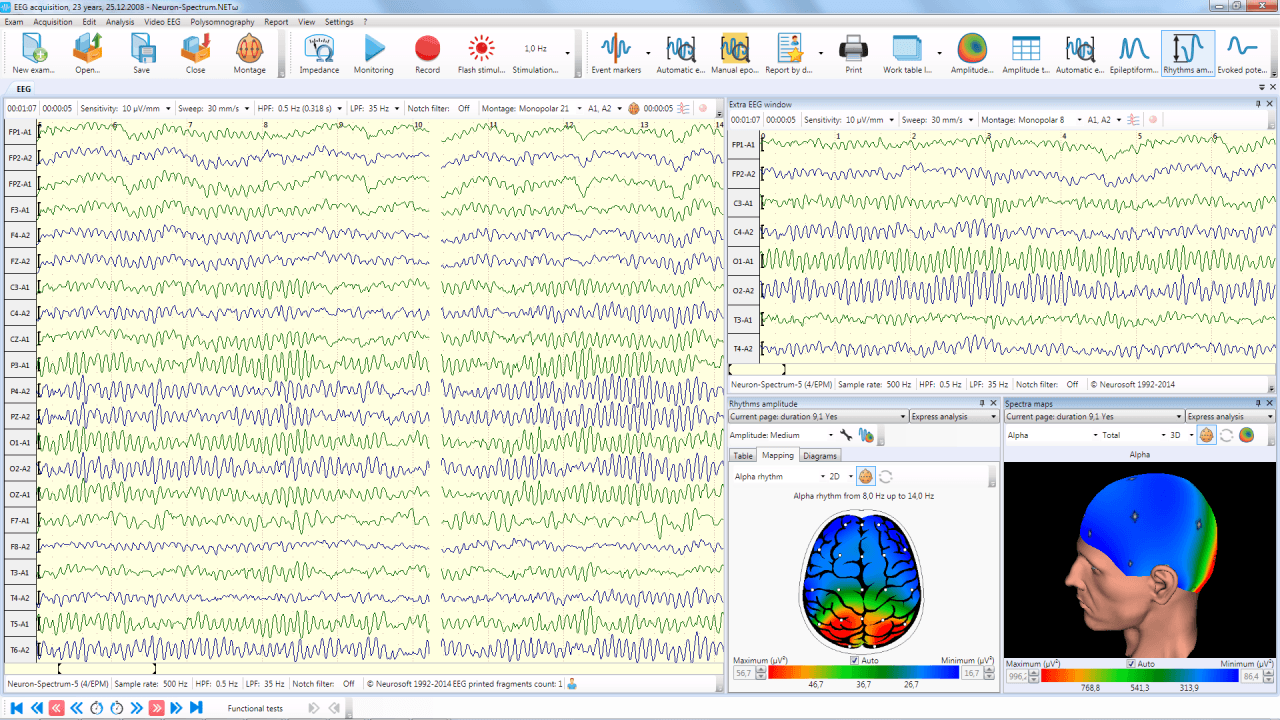 Neuron-Spectrum-1