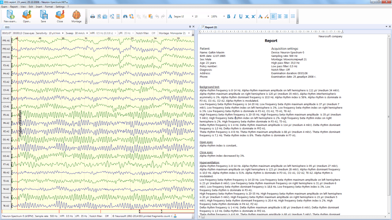 Neuron-Spectrum-1