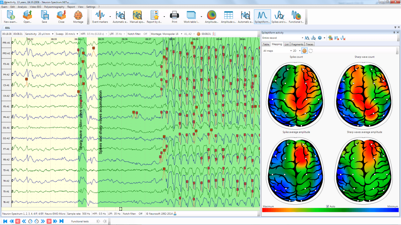 Neuron-Spectrum-1