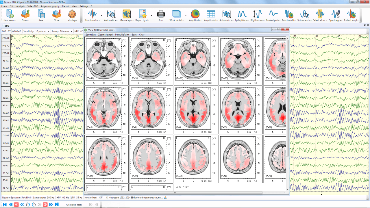 Neuron-Spectrum-1