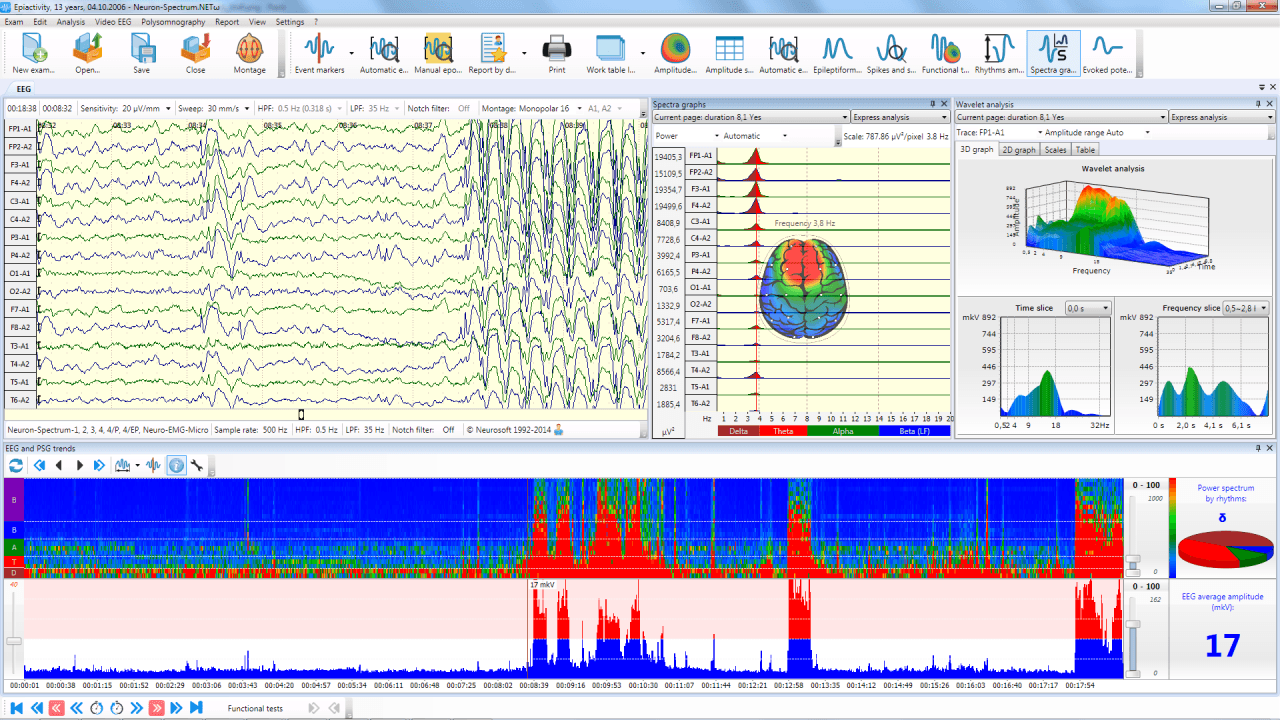 Neuron-Spectrum-1