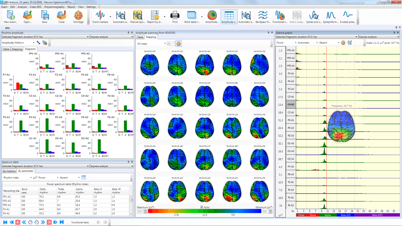 Neuron-Spectrum-3
