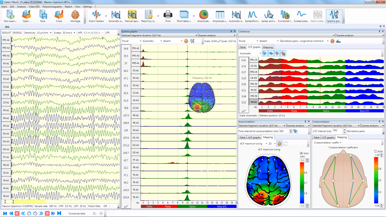 Neuron-Spectrum-4/P
