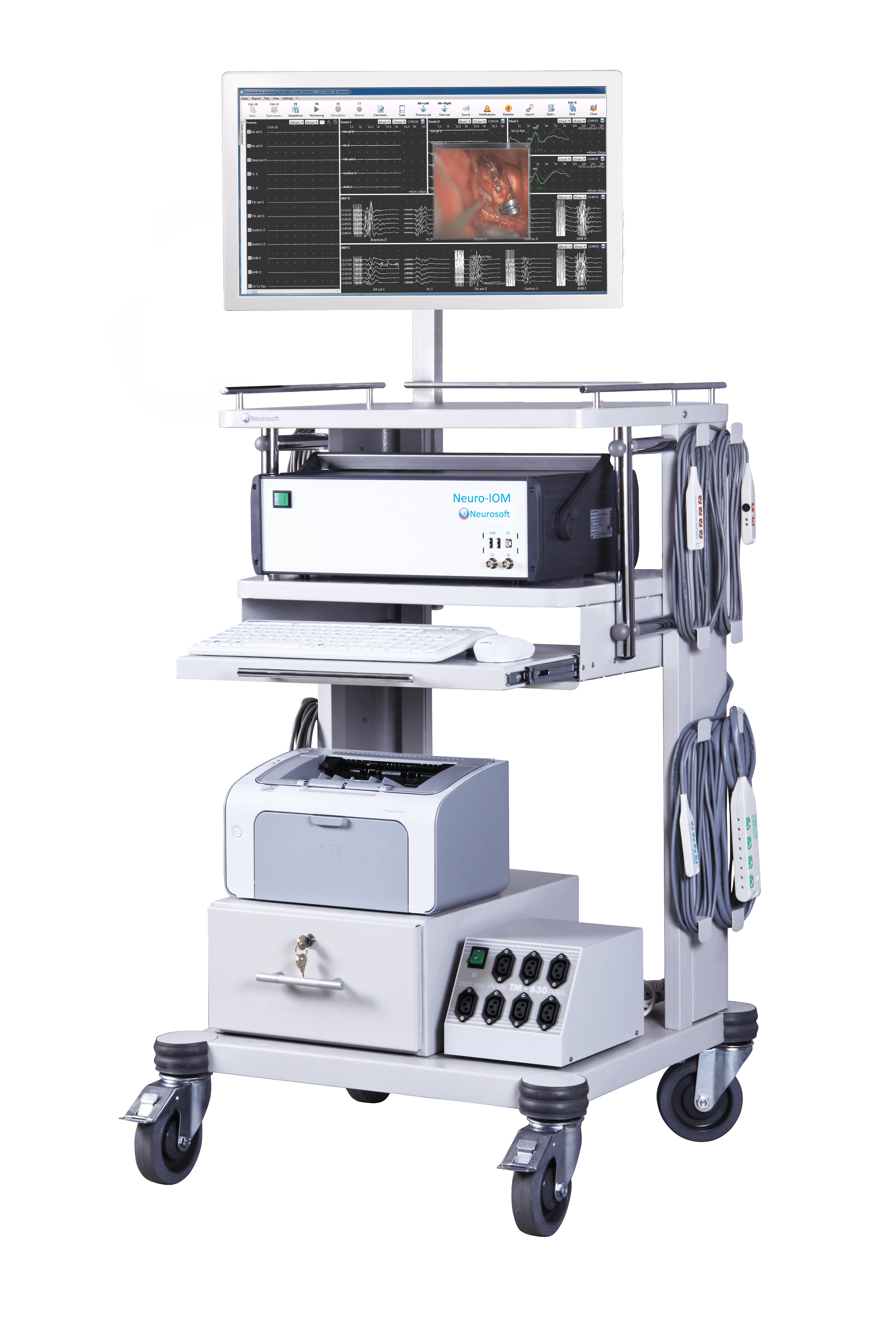 Neuro-IOM-32/B