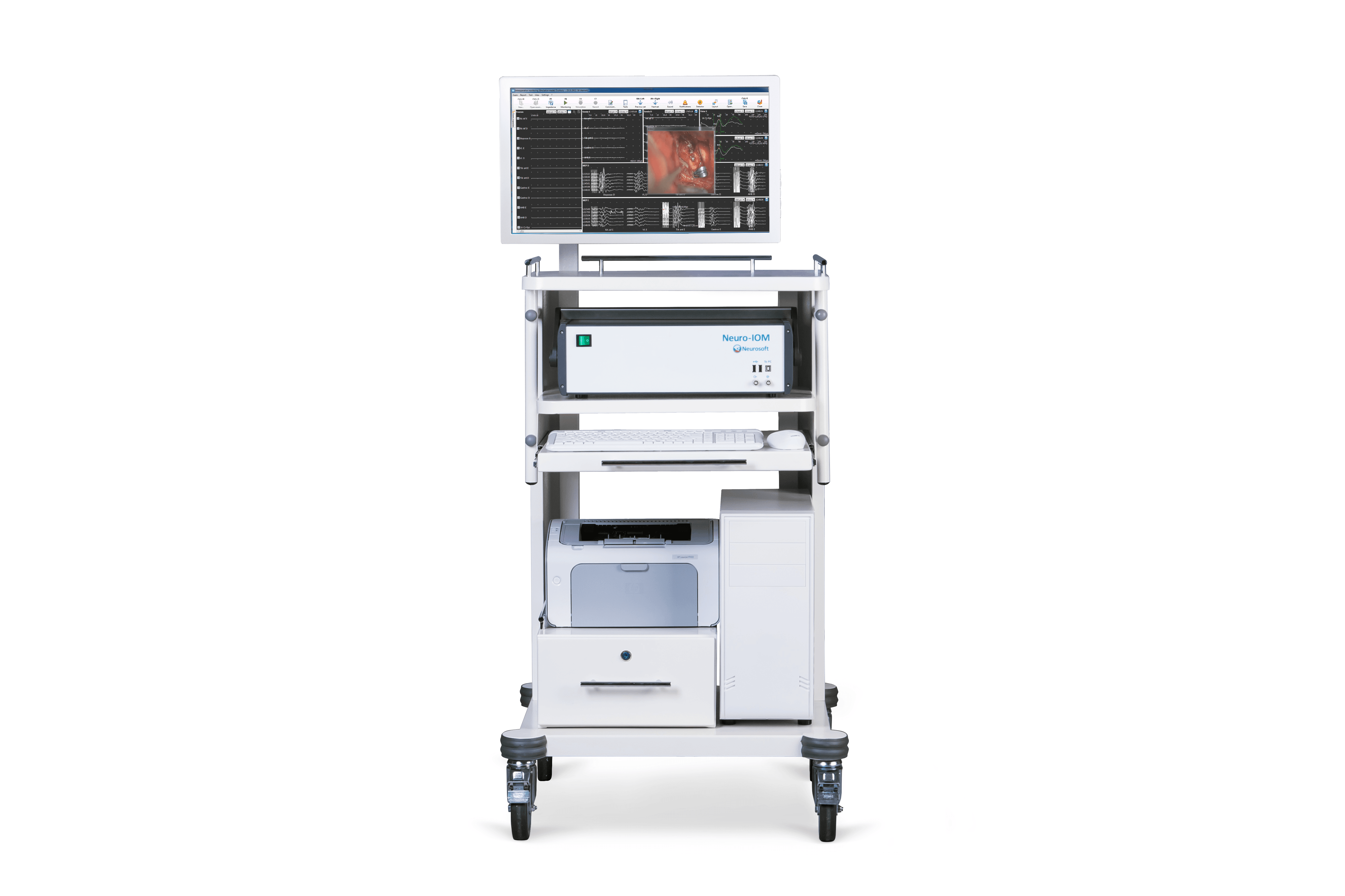 Neuro-IOM-32/B