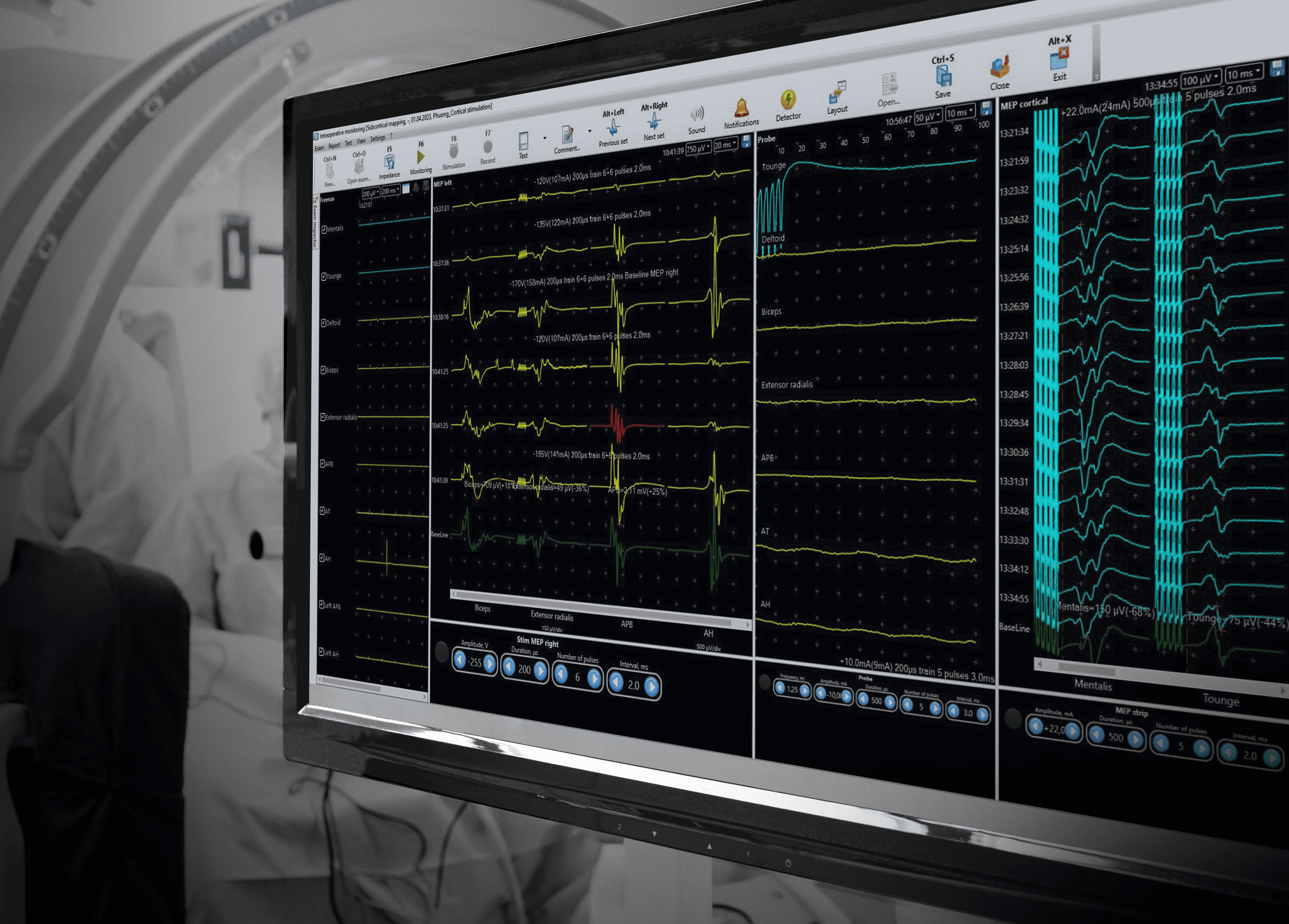 Neuro-IOM-32/B