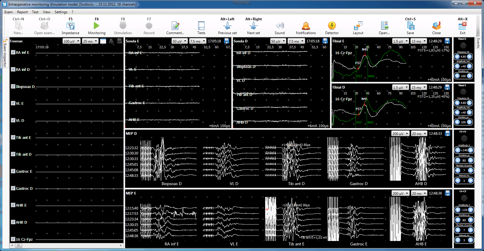Neuro-IOM-16/S