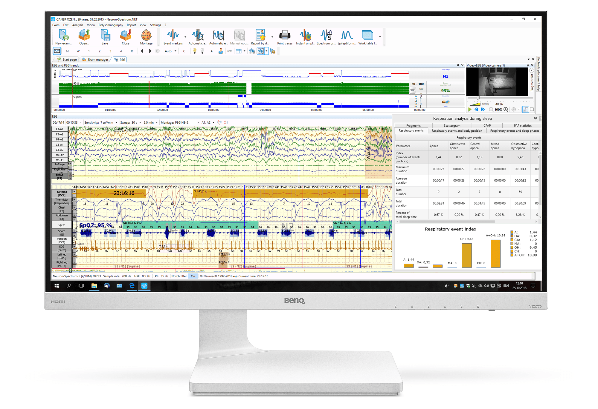 Neuron-Spectrum-AM/PSG (Loại I)