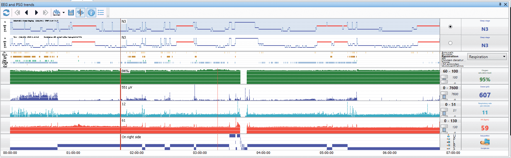 Neuron-Spectrum-AM/PSG (Loại I)