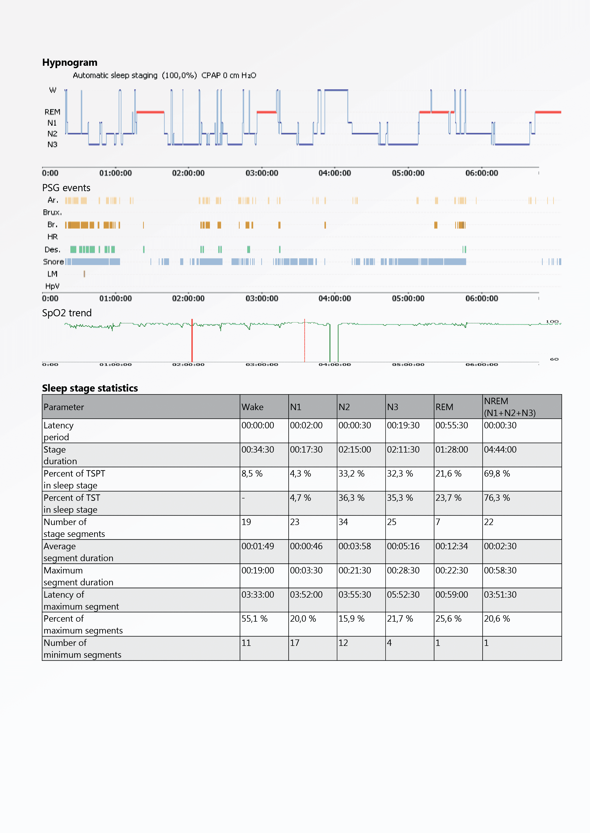 Neuron-Spectrum-AM/PSG (Loại I)