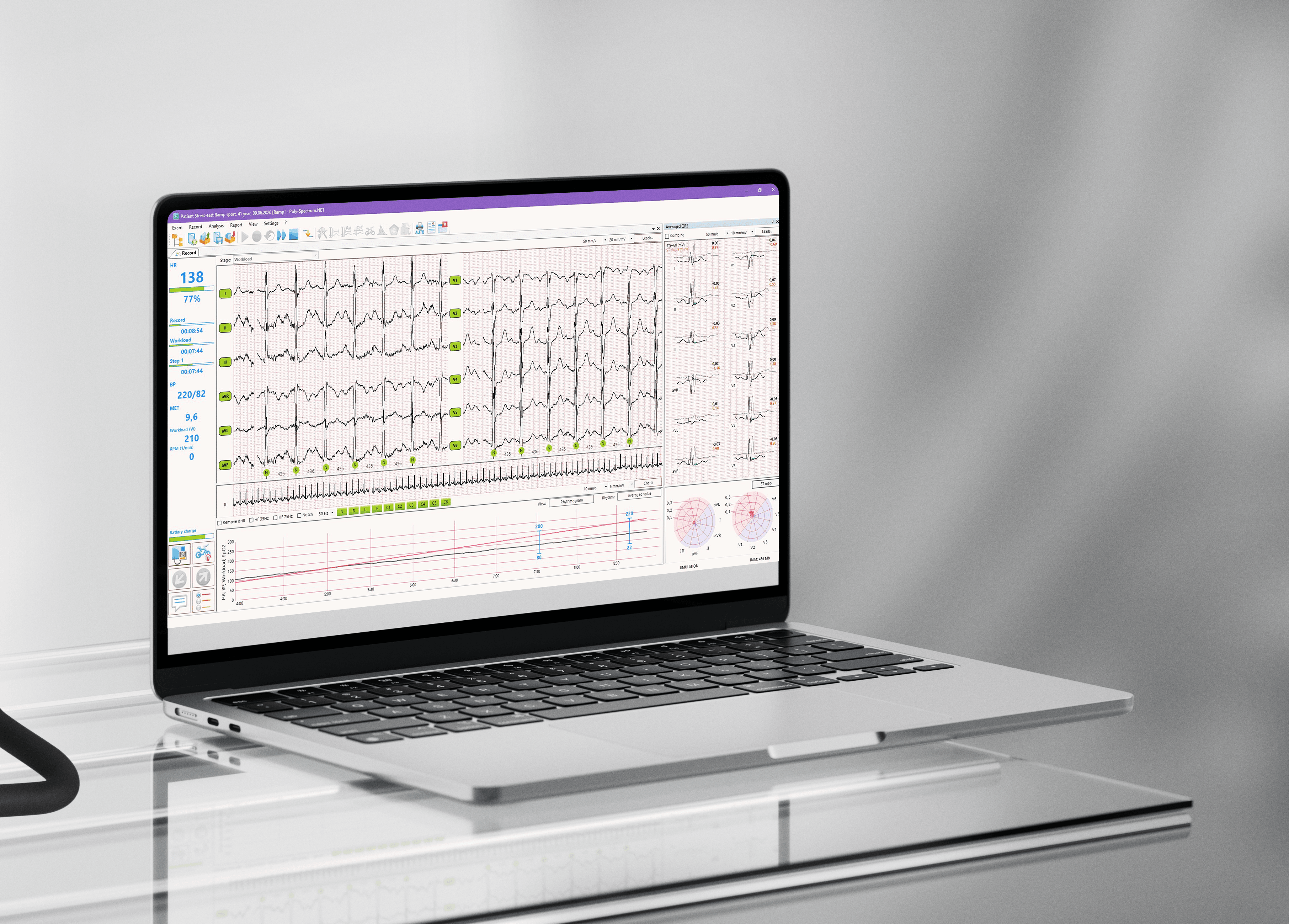 Ergopoint (với máy đo công suất đạp xe)