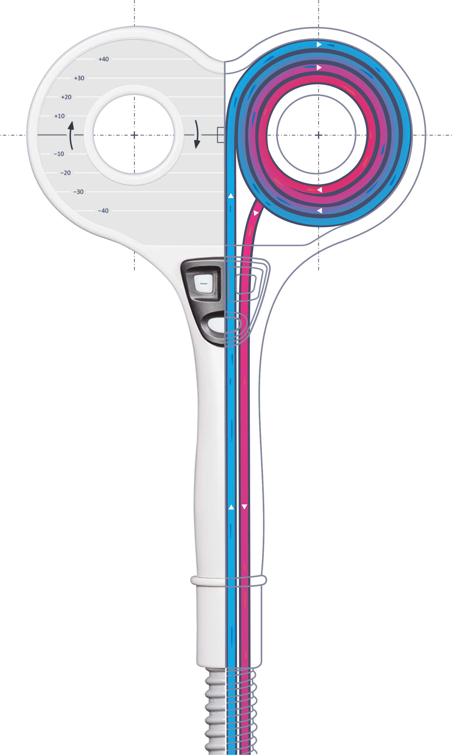 Neuro-MS Đơn pha thần kinh