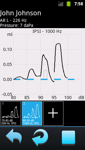 Audio-SMART